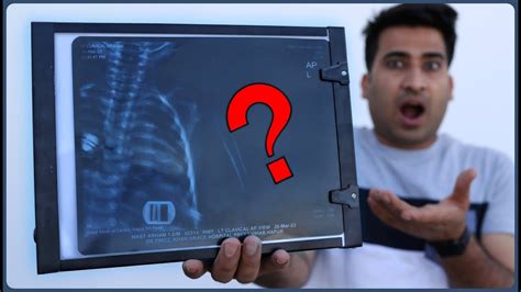 O Bhai X RAY View Box Ke Ander Ye Hota Hai Pata Nahi Tha YouTube