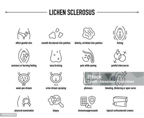 Lichen Sclerosus Symptoms Diagnostic And Treatment Vector Icons Stock