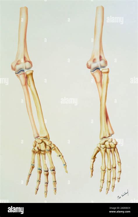 Arm skeleton. Illustration of the bones of the arm, showing their ...