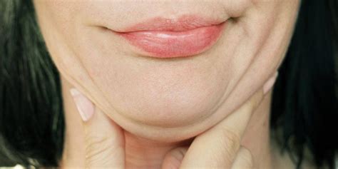 Double Chin Reduction Treatment Dr Batul Patel