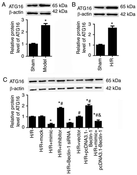 Mir‑30a‑5p Mitigates Autophagy By Regulating The Beclin‑1atg16 Pathway