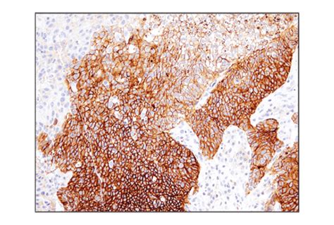 Cd D O P Rabbit Mab Cell Signaling Technology