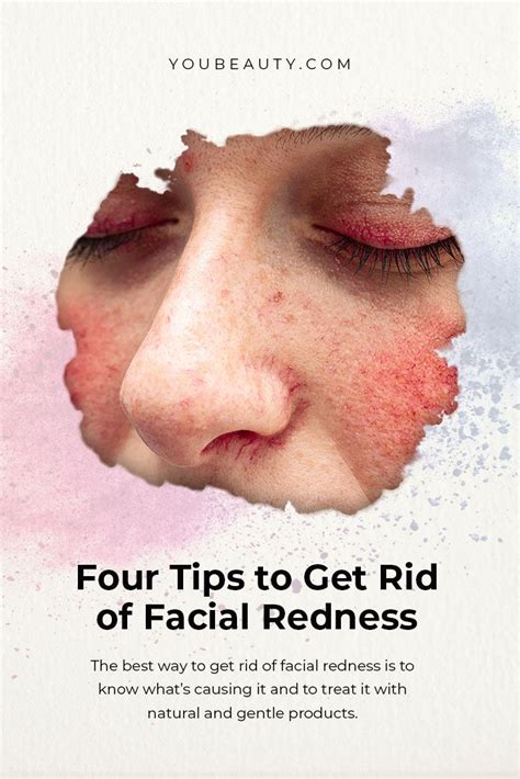 Four Tips To Get Rid Of Facial Redness The Best Way To Get Rid Of Facial Redness Is To Know