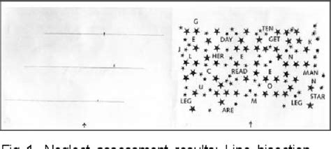 Figure 1 From The Effect Of Visual Cue Deprivation For The Head Alignment On Unilateral Neglect