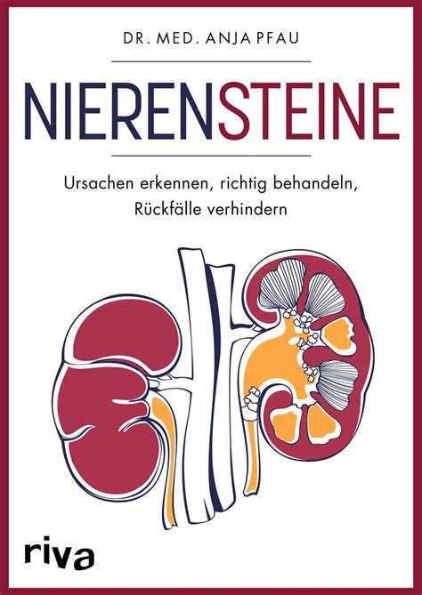 Nierensteine Ursachen Erkennen Richtig Behandeln Jetzt Online