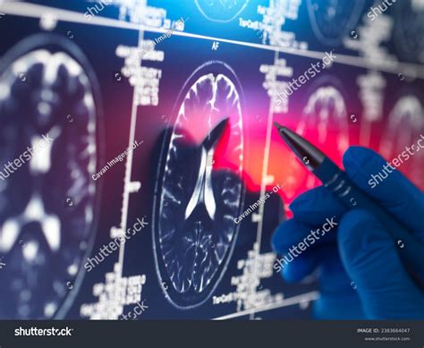 Doctor Viewing Patients Brain Scan On Stock Photo 2383664047 | Shutterstock