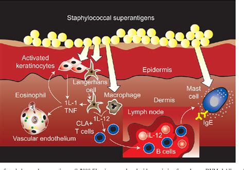 Figure 2 From The Role Of Staphylococcus Aureus In Atopic Eczema