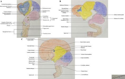 Lesions At The Foramen Of Monro Causing Obstructive Hydrocephalus Intechopen