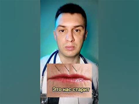 Избавляемся от морщин вокруг губ - YouTube