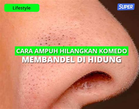 10 Cara Menghilangkan Komedo Di Hidung Dengan Ampuh