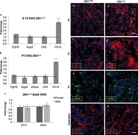 Ck Progenitor Stem Cell Marker Expression Is Upregulated During