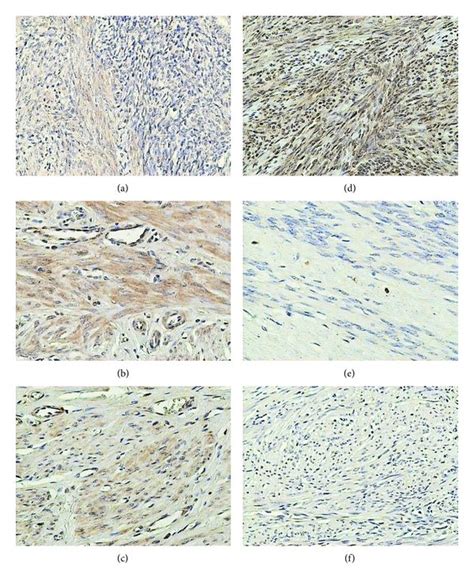 Immunohistochemical Staining Of Uterine Samples From Reproductive