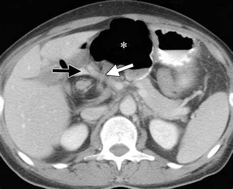 Peritoneal And Retroperitoneal Anatomy And Its Relevance For Cross