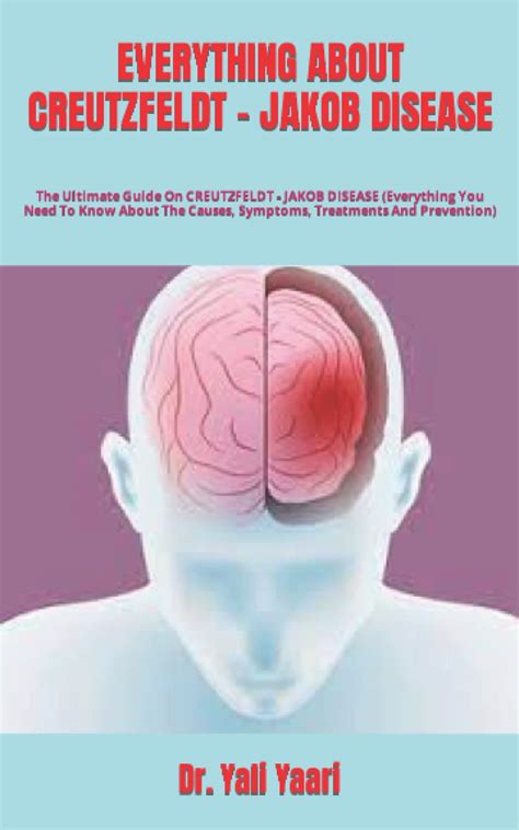 Buy Everything About Creutzfeldt Jakob Disease The Ultimate Guide On