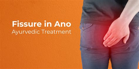 Treatment For Fissure In Ano