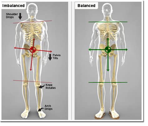 One Leg Shorter Than The Other Causing Hip Pain