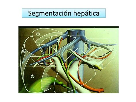 Ppt Opciones T Cnicas En El Trasplante Hep Tico Powerpoint