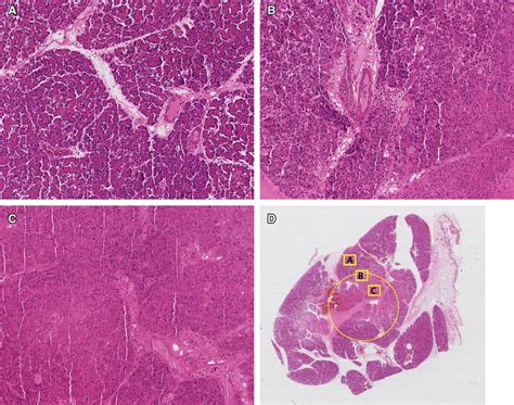 Histopathologic Findings Of The Pancreas Parenchyma A Normal Area Of