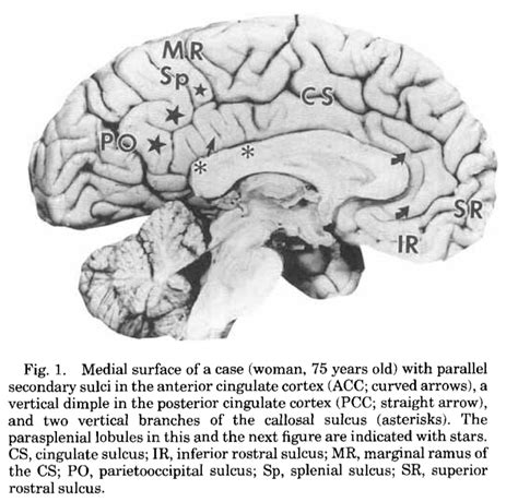 Anterior cingulate — Practice and theory of brain imaging