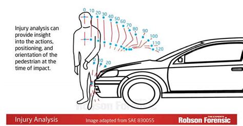 Biomechanical Reconstruction Of A Pedestrian Struck By A Vehicle