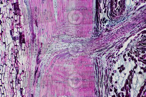 Pinus Sp Pine Radial Longitudinal Section 64x Stem Pinus Sp