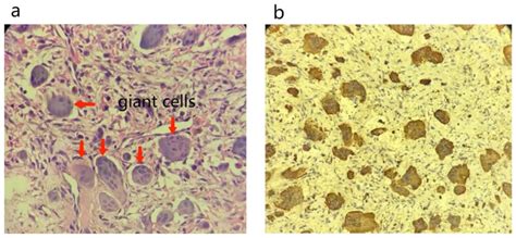 Histopathological Examination Report Photomicrograph Of The Left