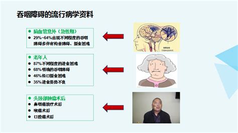 【健康科普】第二季上线！吞咽障碍患者的摄食训练 内蒙古科技大学包头医学院第一附属医院