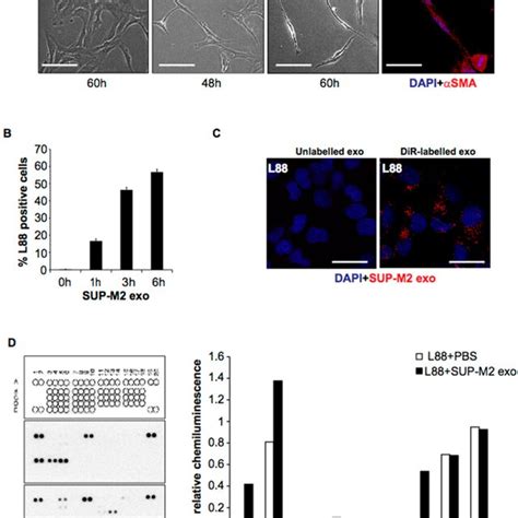 Molecular Profiling Of Alk And Alk Alcl Derived Exosomes A Download Scientific Diagram