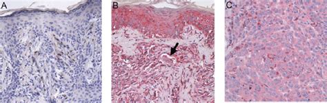 Calreticulin Immunohistochemistry A Negative Control Performed With Download Scientific