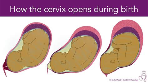 Transformation Of The Uterus During Labour YouTube