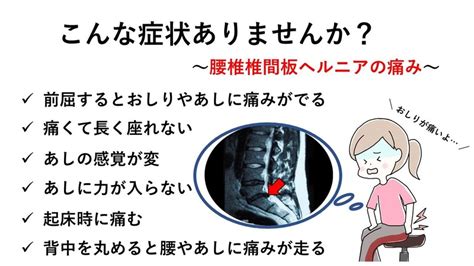 腰椎椎間板ヘルニアの症状と運動療法、ストレッチについて アレックス脊椎クリニック