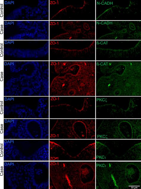 Confocal Analysis Performed After Double Immunostaining On Sections Of