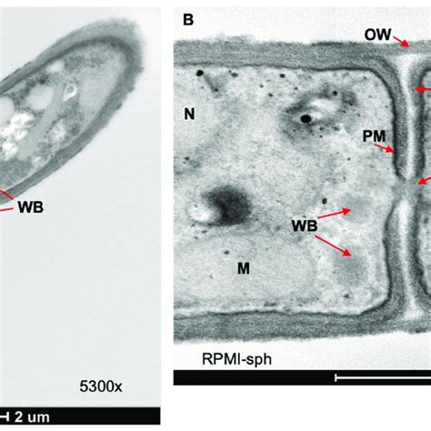 Tem Images Of C Posadasii S E Strain Following H Growth In