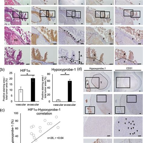 Expression Analysis Of Hypoxia Related Proteins In ES 2 Disseminated