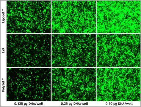 LipoJet™ In Vitro Transfection Kit (Ver. II)