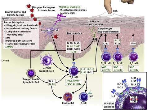 New Treatments In Atopic Dermatitis Annals Of Allergy Asthma And Immunology