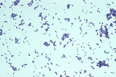 Arcanobacterium Haemolyticum Gram Stain