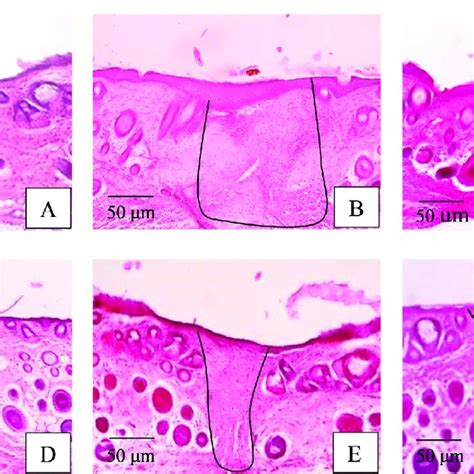 Photomicrograph Of The Cross Section Of Mice Skin From Each Treatment