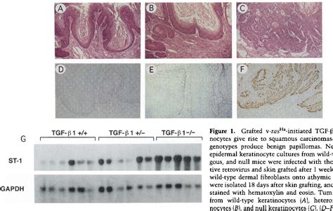 Pdf Targeted Deletion Of The Tgf Pi Gene Causes Rapid Progression To