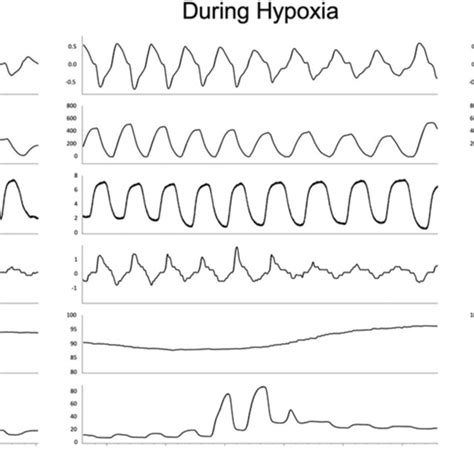 A Representative Polygraph Recording Of The Intermittent Hypoxia