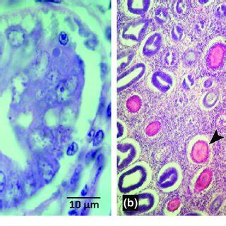 Histological Section Of Hepatopancreas Of Penaeus Vannamei A