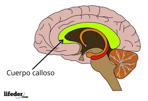 Cuerpo Calloso Función Partes Enfermedades