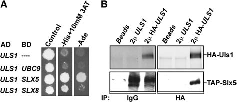 Physical Interactions Between Uls And Slx Slx A Plasmids