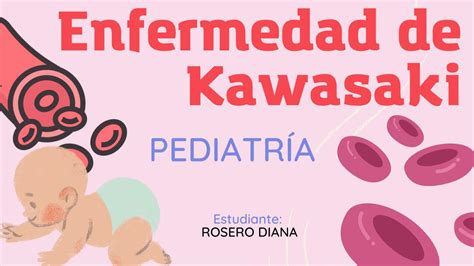 Enfermedad De Kawasaki Notas Med Udocz