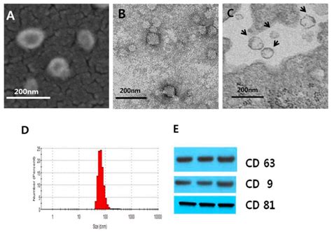 Characterization Of Extracellular Vesicles Evs A Scanning Electron