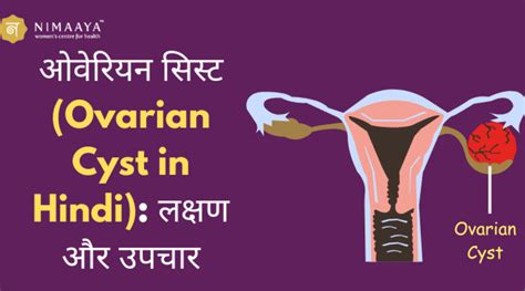 Ovary Meaning In Hindi Archives Nimaaya