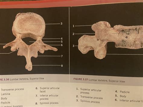 Lumbar Vertebrae (L1 - L5), figure 3.36 & 3.37 Diagram | Quizlet