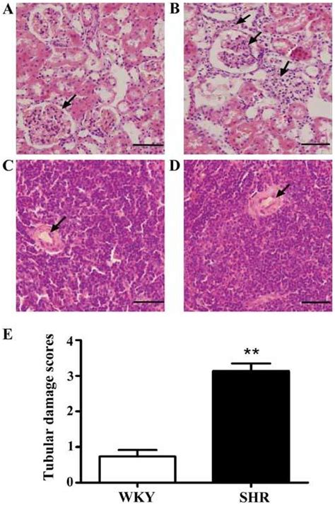 Histopathological Changes In The Kidney And Spleen Sections As Shown By