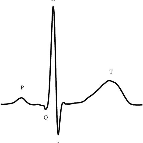 Schematic ECG waveform of a normal cardiac cycle.... | Download Scientific Diagram