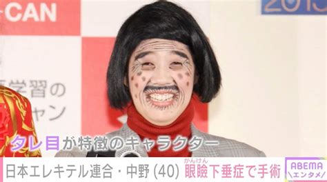 【写真・画像】日本エレキテル連合・中野聡子、眼瞼下垂症で手術 テープメイク酷使で「まぶたが終わりました」 1枚目 エンタメ総合